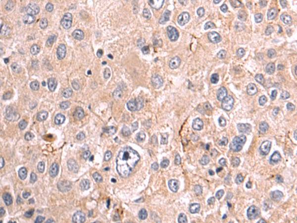 Pak Bbi D Anti Pak Rabbit Polyclonal Antibody